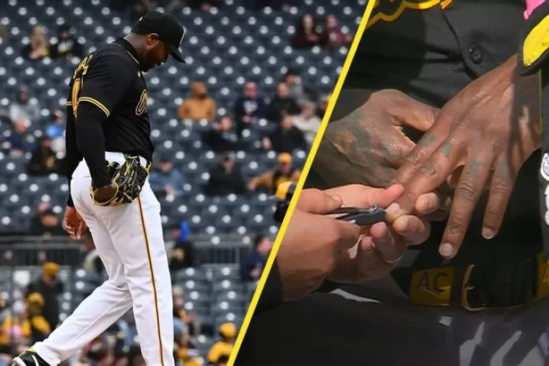 El peculiar incidente de Aroldis Chapman Le cortan las unas en pleno juego