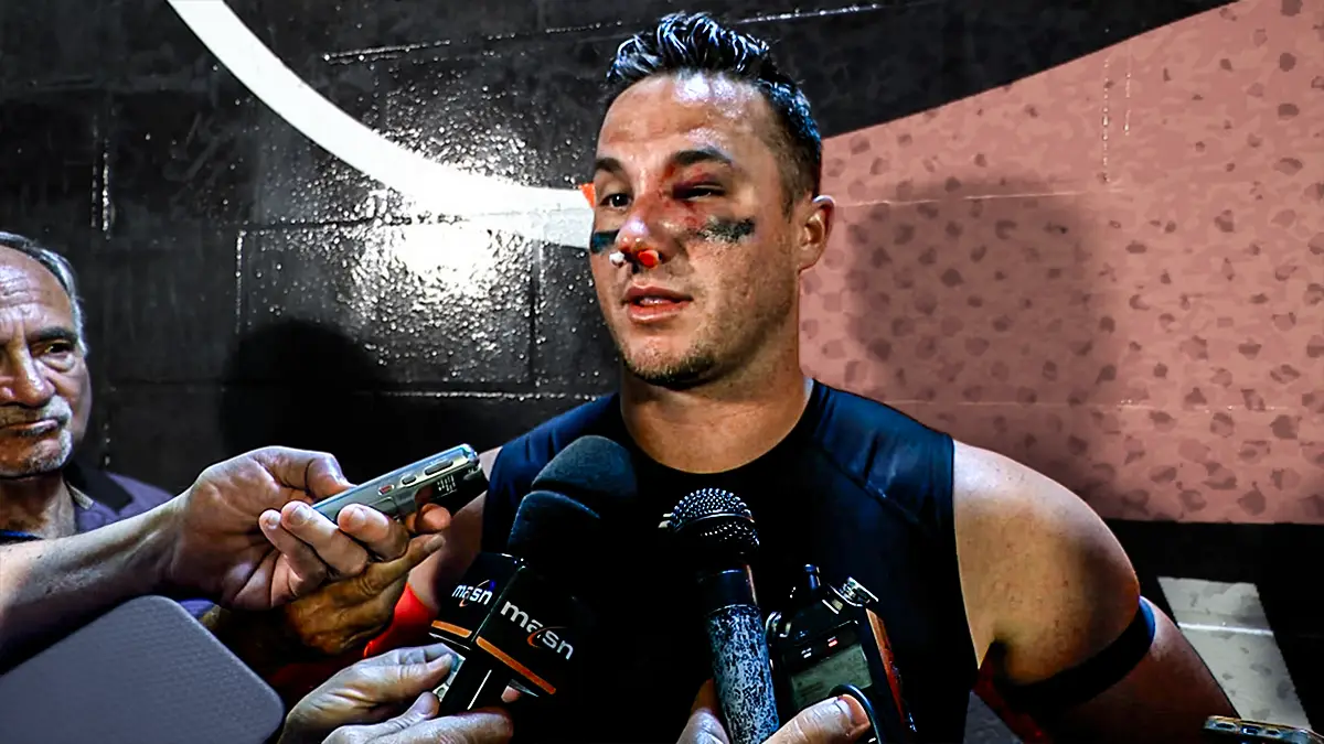 La valentia de James McCann resplandece en el juego Orioles vs Azulejos